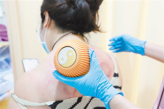 醫(yī)護(hù)人員在夜間門診為患者拔火罐。