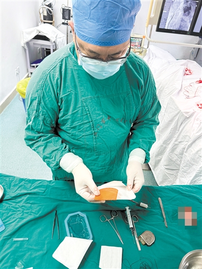 醫(yī)生在準備TYRX可吸收抗菌封套。